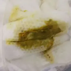 Jak wyglądają kupki przy ząbkowaniu? Co powinno niepokoić rodziców?