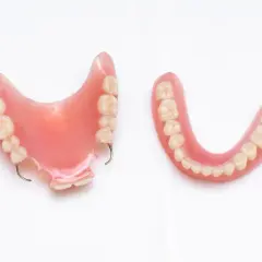Due protesi dentali mobili, una con gancio metallico, pronte a ridare un sorriso completo.