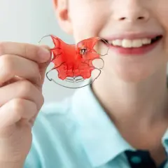 Niño sonriente muestra un aparato de ortodoncia rojo, un twin block, para corregir su mordida.