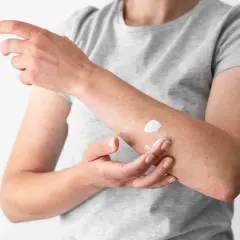Persona aplica crema en su brazo, quizás para tratar hongos en la piel porque salen por humedad o contacto.