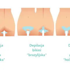 Depilacja bikini: Jak wygląda? Rodzaje, przebieg, porady ekspertki