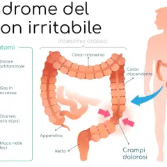 Illustrazione della sindrome del colon irritabile, con sintomi come dolore addominale, gas, diarrea/stipsi e muco. Evidenzia i crampi dolorosi.