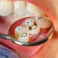 Zęby z namalowanymi buźkami w odbiciu lusterka dentystycznego. Jeden ząb ma próchnicę i wygląda na chorego. Czy zęby się regenerują?