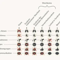 Schema zeigt verschiedene Stadien des Wachkoma, von Koma bis Bewusstsein, und deren Einfluss auf Funktionen wie Atmung und Kommunikation. Es illustriert den wachkoma sterbeprozess.