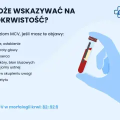 Objawy niedokrwistości: zmęczenie, bóle głowy, bladość. Zbadaj MCV w morfologii krwi.