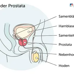 Anatomische Darstellung der Prostata, Harnblase und Hoden. Frühzeitige Erkennung von Prostatakrebs Symptomen ist wichtig.