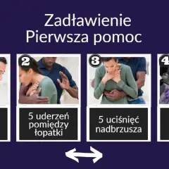 Pierwsza pomoc przy zadławieniu: zachęcaj do kaszlu, wykonaj 5 uderzeń między łopatki, 5 uciśnięć nadbrzusza, a następnie RKO.