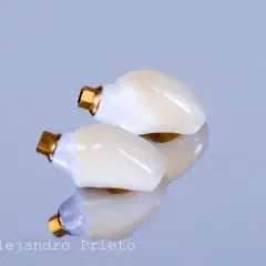 Dos coronas dentales con base dorada, reflejadas en una superficie pulida. La marca "Dr. Alejandro Prieto" sugiere que es el mejor especialista en implantes dentales.