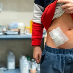 Dziecko z opatrunkiem na brzuchu, po urazie lub zabiegu, który mógł spowodować wstrząs hipowolemiczny.
