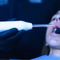 Trattamento laser per come rinforzare le gengive. Un professionista usa uno strumento con luce rossa su una bocca.