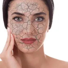 Rostro de mujer con piel agrietada, simulando el daño del estrés oxidativo.