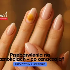 Pomarańczowe paznokcie: moda czy sygnał zdrowia?