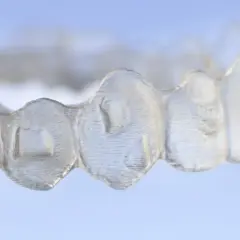 Alineador transparente para atache ortodoncia, mostrando la precisión del tratamiento dental.