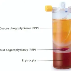 Probówka z rozwarstwionym osoczem: osocze ubogopłytkowe (PPP), koncentrat bogatopłytkowy (PRP) i erytrocyty.
