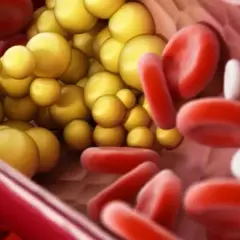 Jakie leki na obniżenie trójglicerydów skutecznie pomogą Ci?