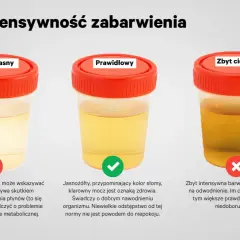 Trzy próbki moczu: zbyt jasny (może oznaczać przewodnienie lub problemy z nerkami), prawidłowy (jasnożółty, jak słoma, świadczy o dobrym nawodnieniu) i zbyt ciemny (wskazuje na odwodnienie).