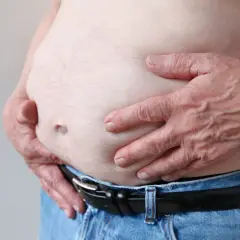 Osoba z zaawansowaną marskością wątroby, widoczny duży brzuch i dłonie obejmujące go.