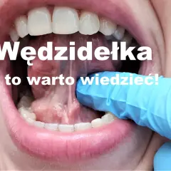 Kiedy zacząć ćwiczyć po podcięciu wędzidełka, aby uniknąć problemów?