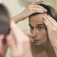 Hombre joven se mira al espejo, tocando su frente, preocupado por la pérdida de cabello.