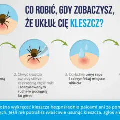 Kleszcz w domu? Jak go bezpiecznie usunąć i sprawdzić, czy nie ma ich więcej