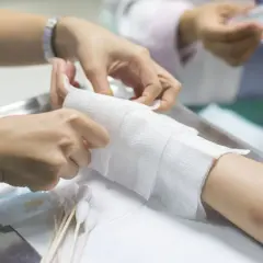 Opatrywanie ręki po oparzeniu primerem kwasowym. Zespół medyczny zakłada opatrunek.