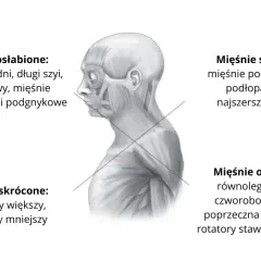 Anatomia głowy i szyi z zaznaczonymi mięśniami. Wskazano mięśnie osłabione, w tym mięśnie nadgnykowe i podgnykowe, oraz skrócone.