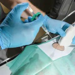 Lekarz pod kontrolą USG wykonuje iniekcję do stawu krzyżowo biodrowego.