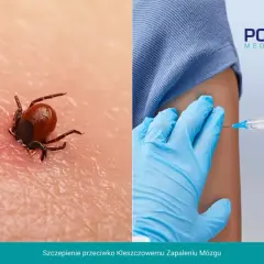 Kleszcz wgryza się w skórę, grożąc kleszczowym zapaleniem mózgu. Zaszczep się, by uniknąć zagrożenia.