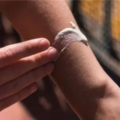 Eine Hand verteilt Sonnencreme auf einem Arm. Hilft Sonnencreme gegen Pickel? Die Haut wird geschützt.