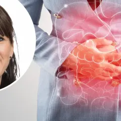Kvinna med blå ögon ler, hennes mage visas med en illustration av tarmarna som lyser rött, vilket symboliserar besvär med colon irritabile.