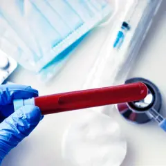 Rękawiczka w niebieskiej rękawicy trzyma probówkę z krwią. Obok leżą maseczka, tabletki, strzykawka i stetoskop. Wyniki badań wskazują, że cholesterol jest podwyższony.