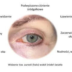 Objawy jaskry: ból oka, głowy, zaczerwienienie, łzawienie, zamazane widzenie, nudności. Po leczeniu wyleczyłem jaskrę.