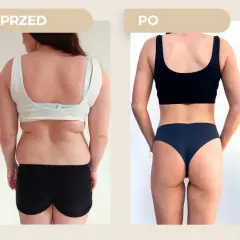 Przed i po: metamorfoza sylwetki. Post przerywany 14/10 przyniósł widoczne efekty.