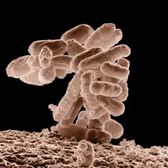 Bakterie na powierzchni, być może pod wpływem erytromycyny, tworzą skupisko. Skala 1 µm.