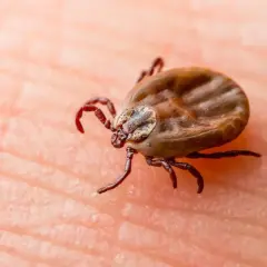 Kleszcz na skórze, potencjalne źródło choroby z Lyme.