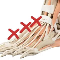 Anatomia del piede con tre croci rosse sui tendini del dorso. Possibili rimedi per il dolore sul dorso del piede.