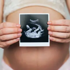 Dłoń kobiety trzyma zdjęcie USG z widocznym dzieckiem i łożyskiem na przedniej ścianie macicy.