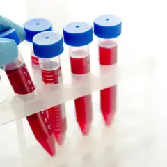 Rękawiczka pobiera probówkę z krwią. W stojaku widać więcej próbek, sugerując, że wyniki badań, np. **pdw podwyższone**, mogą wymagać dalszej analizy.