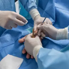 Chirurg ręki: Jak wybrać najlepszą klinikę i specjalistę?