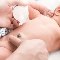 Delikatne czyszczenie pępka noworodka, aby zapobiec zapaleniu pępka. Dłoń aplikuje płyn z butelki na pępek.