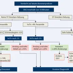 Myokardinfarkt Diagnostik: Wichtige Tests und Symptome erkennen