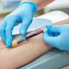 Pobieranie krwi do badań. Lekarz w niebieskich rękawiczkach pobiera krew, by sprawdzić, jak szybko obniżyć próby wątrobowe.