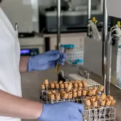 Laborant w rękawiczkach bada próbkę, zastanawiając się, ldh co to. W tle stoją liczne probówki.