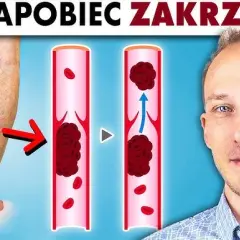 Zakrzepica jaki lekarz: jak uniknąć błędnych decyzji medycznych