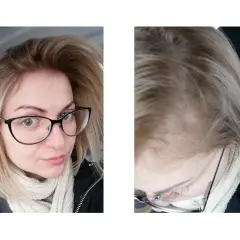 Jak wybrać farbę do ciemnego odrostu przy blondzie i uniknąć kontrastu