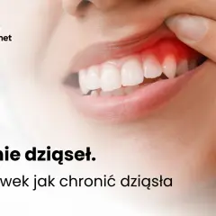 Zapalenie dziąseł: co robić, by uratować dziąsła i zęby? Poradnik.