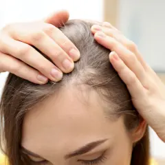 Manos revisando el cuero cabelludo, buscando señales de que el pelo pueda crecer.