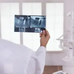 Dentysta analizuje RTG zęba z implantem. Zastanawia się, ile kanałów ma 6.