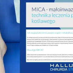 Jak zrobić opatrunek po operacji haluksa - uniknij błędów i bólu