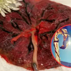 Co robią z łożyskiem po porodzie? 5 zaskakujących możliwości